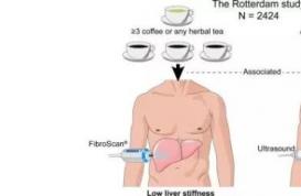 大型研究发现：喝咖啡还能预防肝硬化